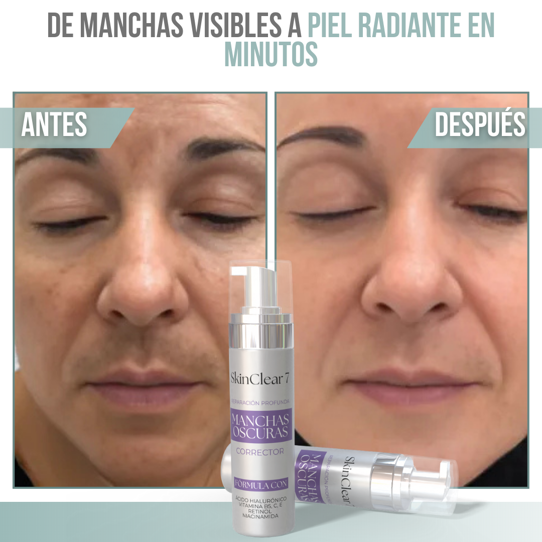 SkinClear 7™ - Dile adiós a las manchas, revela tu piel radiante.