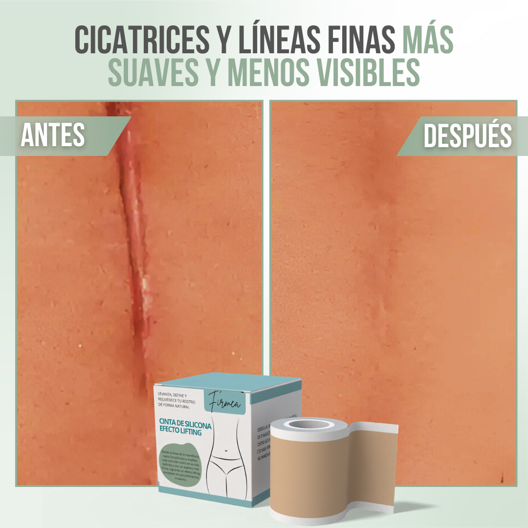 FIRMEA™ - Levanta, define y rejuvenece tu piel de forma natural