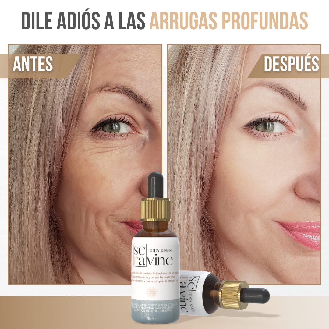 SERAVINE™ - Una mirada fresca y rejuvenecida al instante