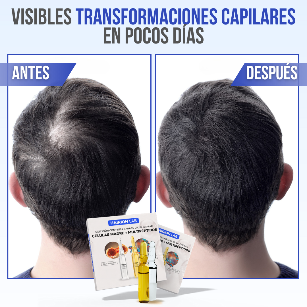 HAIRIONLAB™ - Recupera la fuerza y densidad de tu cabello, naturalmente