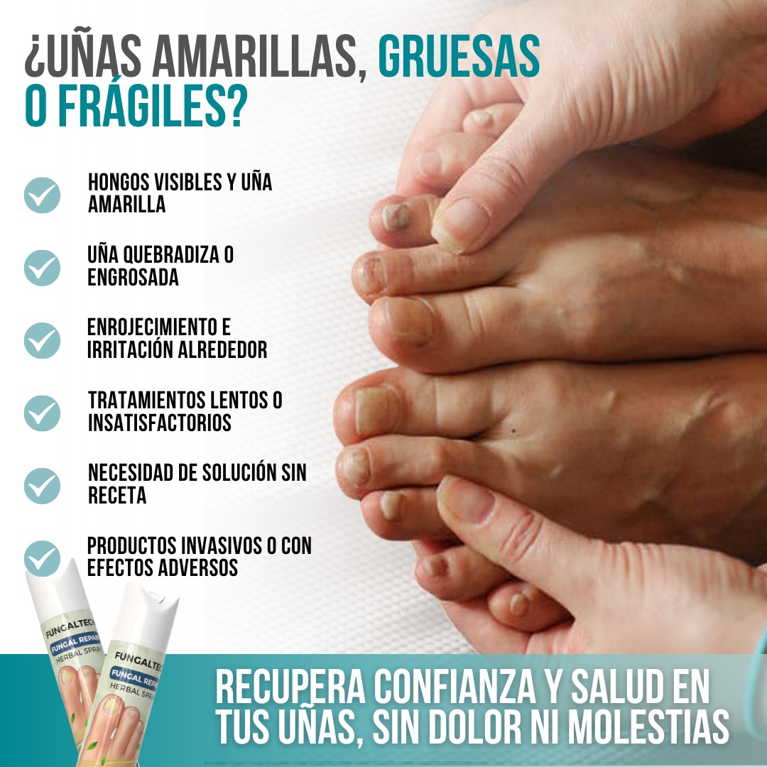 FungalTech™ - Recupera la salud de tus uñas de manera rápida y natural