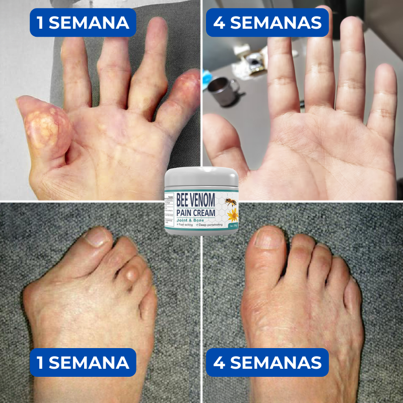 JointFlex™ - Crema para el dolor y la inflamación de articulaciones