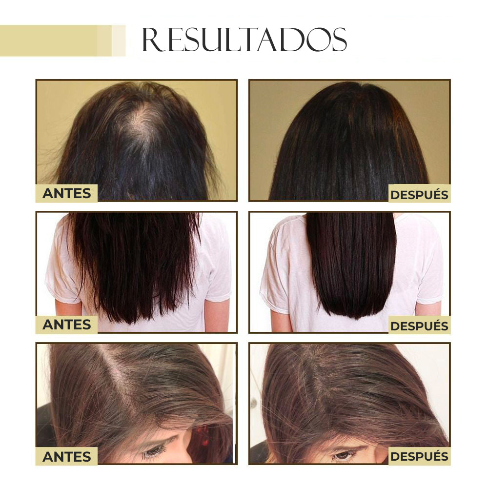 DivineDose™ - Aceite esencial fortalecedor de cabello
