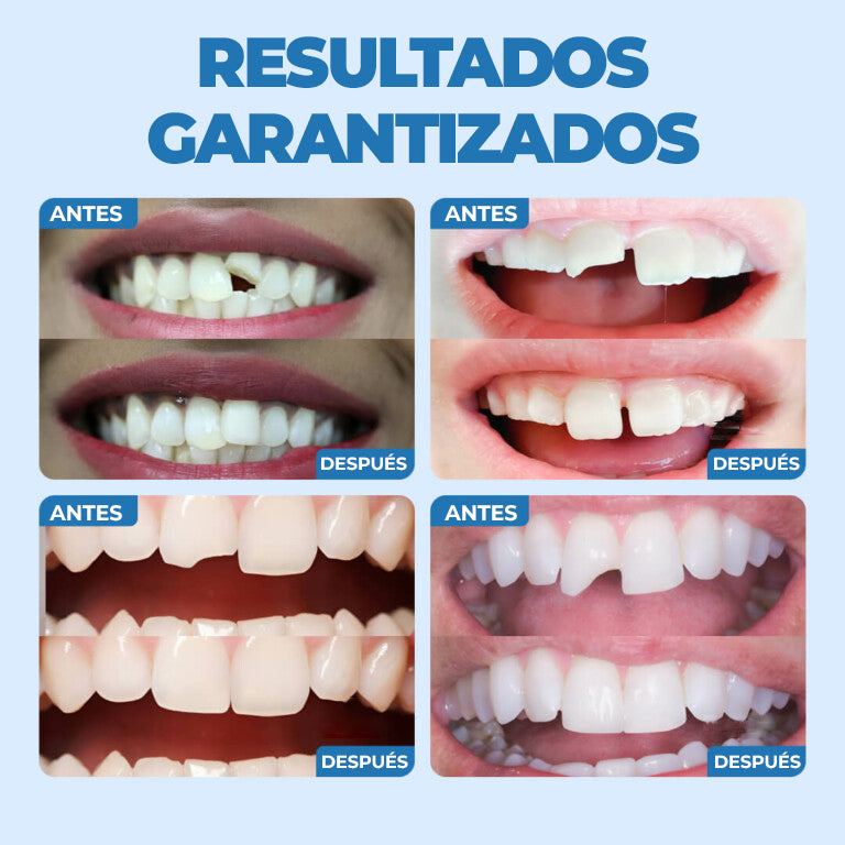 SmileSaver™ - Kit de dientes postizos