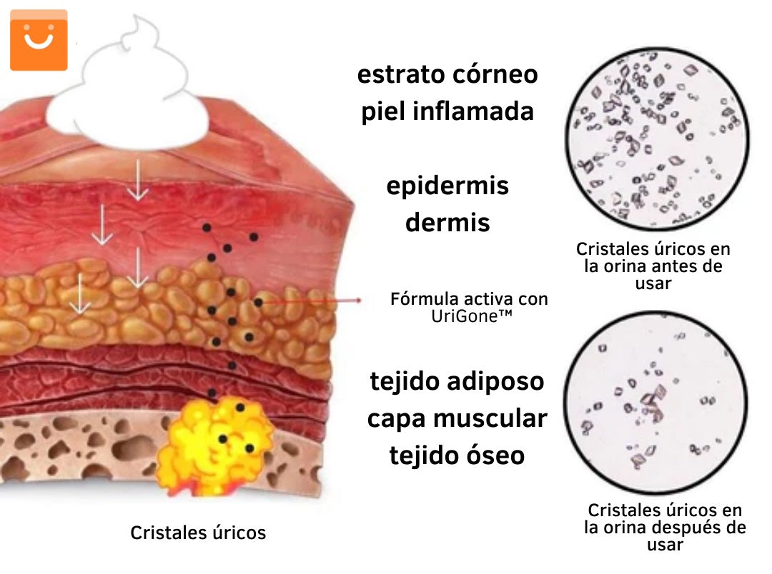 UriGone™ - Tratamiento para la gota | Oferta Exclusiva 2x1