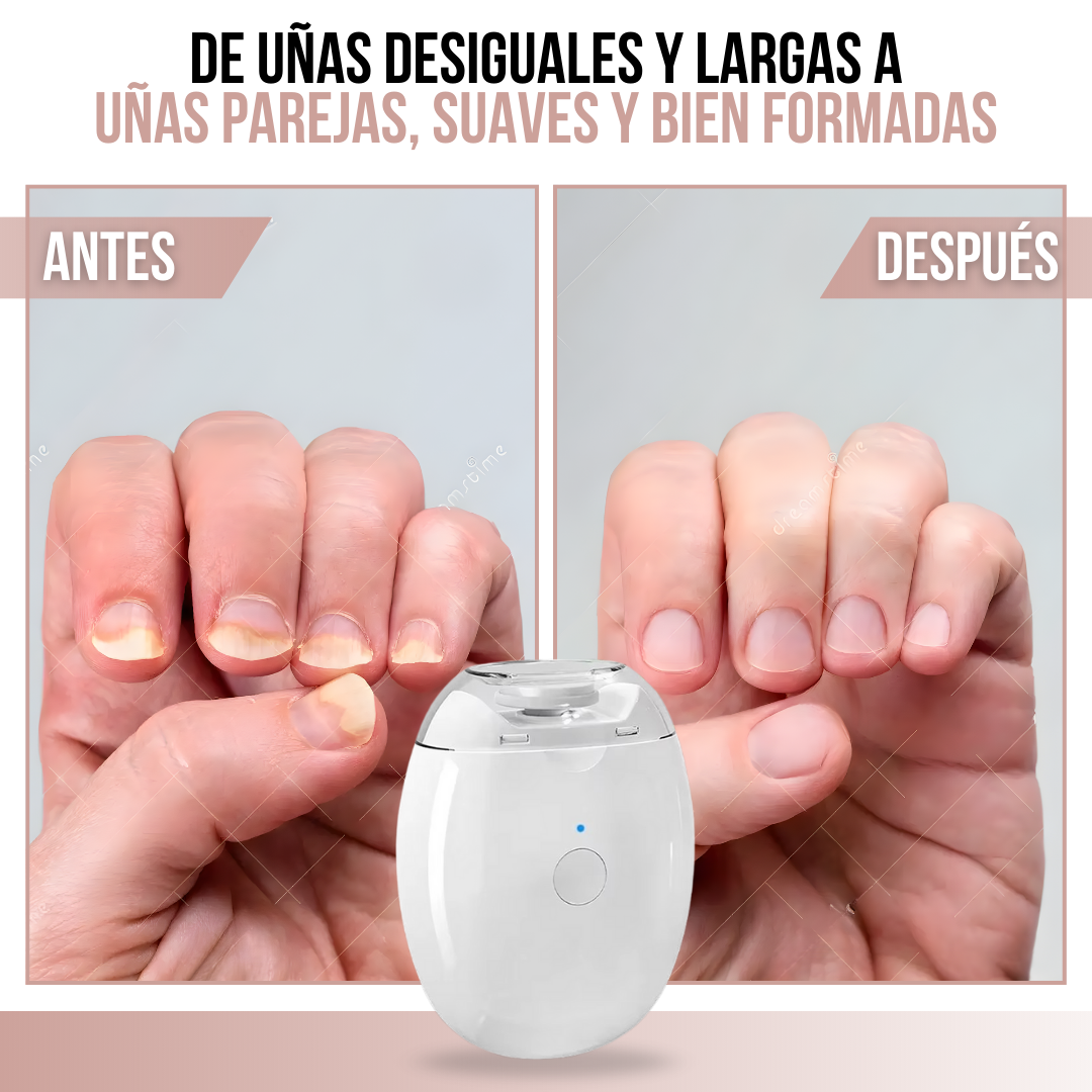 Nail Soft Pro™ - cuidado delicado para uñas pequeñas y grandes
