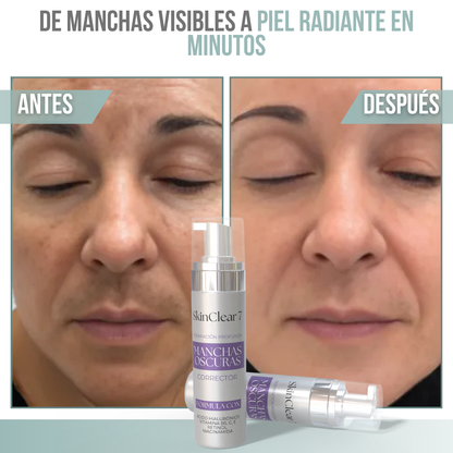 SkinClear 7™ - Dile adiós a las manchas, revela tu piel radiante.