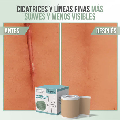 FIRMEA™ - Levanta, define y rejuvenece tu piel de forma natural