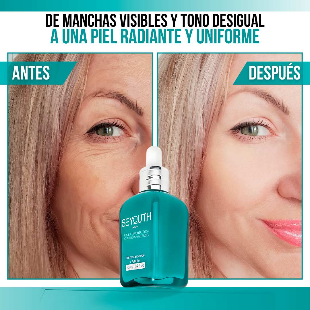 SEYOUTH™ - Despierta con una piel renovada, suave y firme