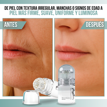 Micro Restoration™ - Belleza de nivel profesional, sin salir de casa