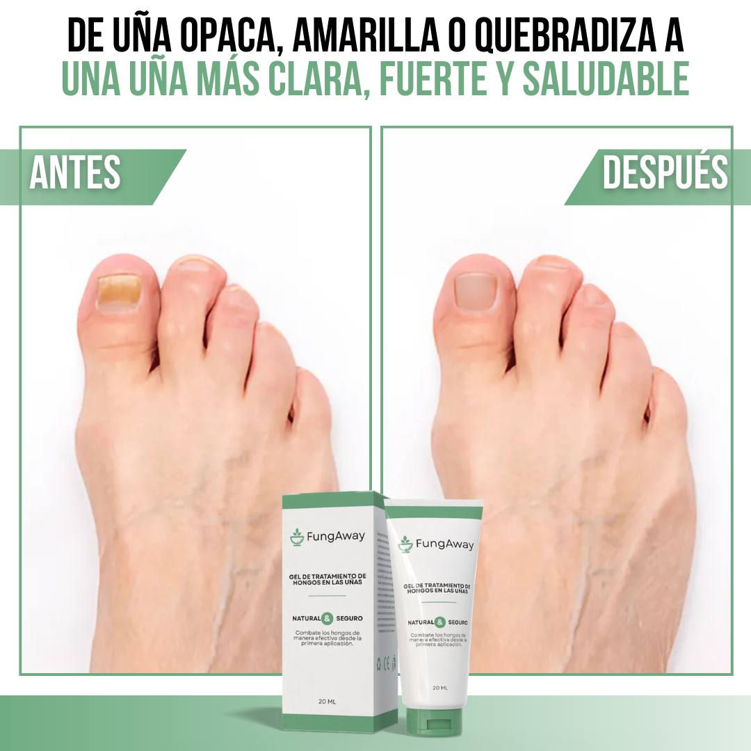 FungAway™ - Uñas fuertes, sanas y libres de hongos desde la raíz