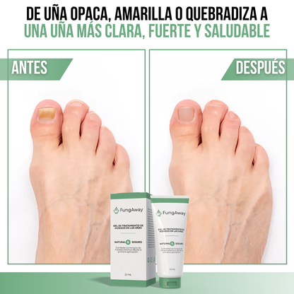 FungAway™ - Uñas fuertes, sanas y libres de hongos desde la raíz