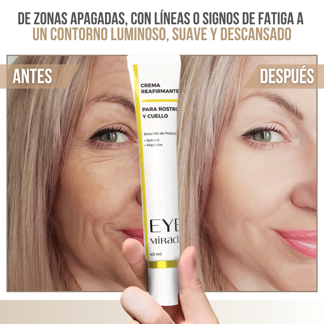 Eye Miracle™ – Revive tu mirada, renueva tu piel
