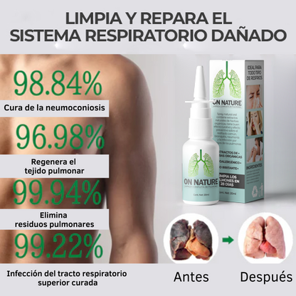 OnNature™ - Rociador para desintoxicar el sistema respiratorio