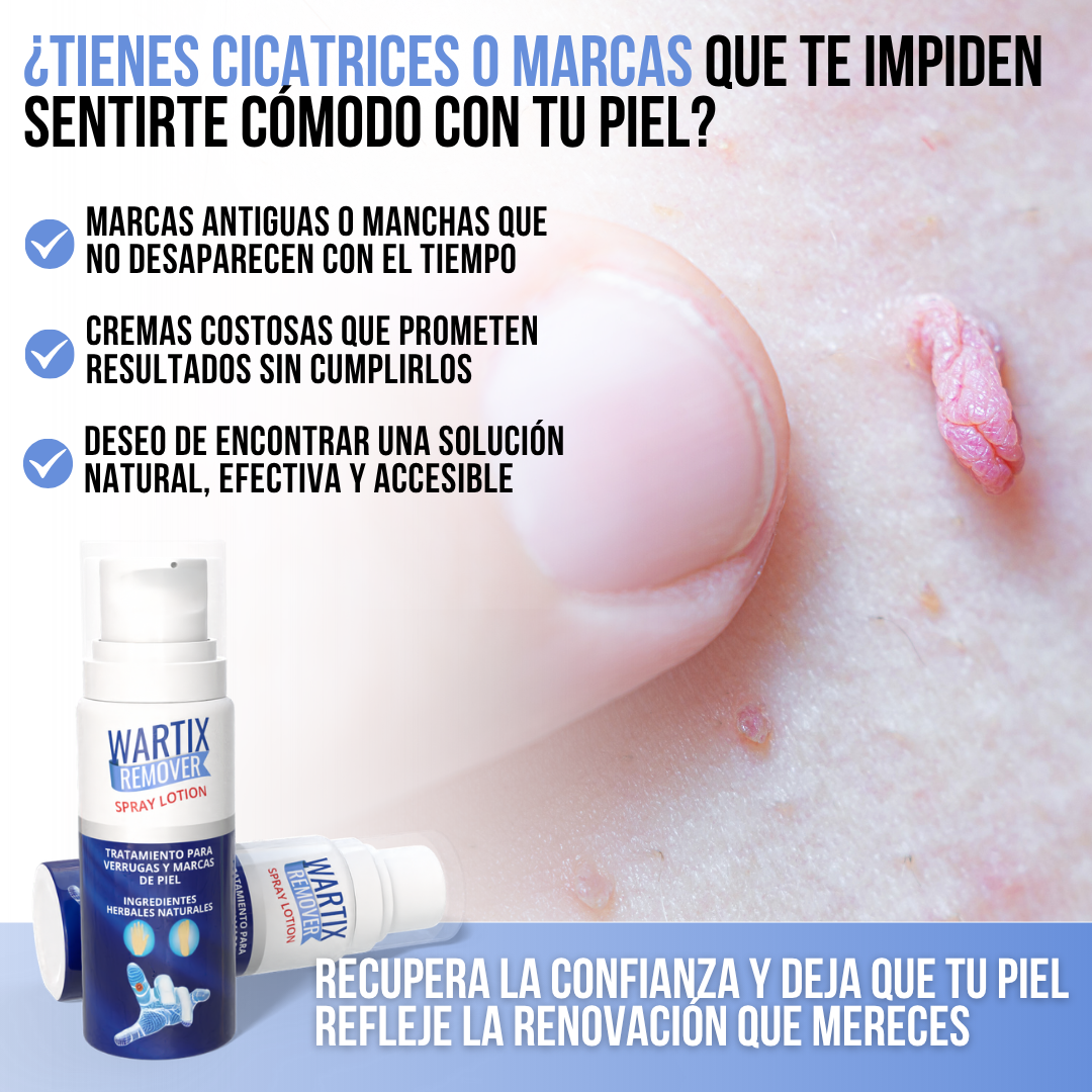 WARTIX REMOVER™ - Elimina verrugas y lunares con suavidad y rapidez
