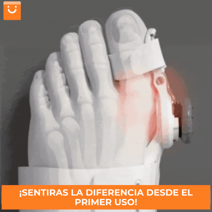 HALLUXCARE™ - CORRECTOR DE JUANETES – ALEGRES CL