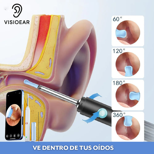 VisioEar™ – Limpieza guiada por cámara HD