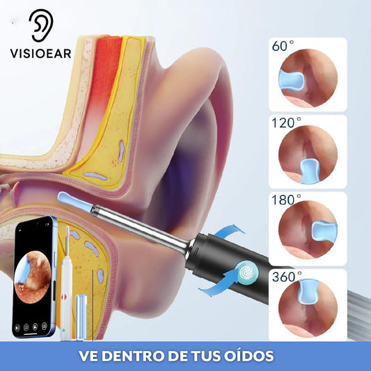 VisioEar™ – Limpieza guiada por cámara HD