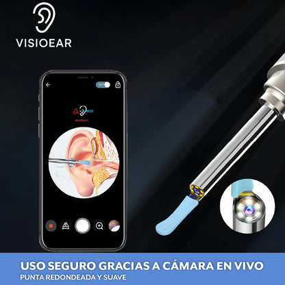 VisioEar™ – Limpieza guiada por cámara HD