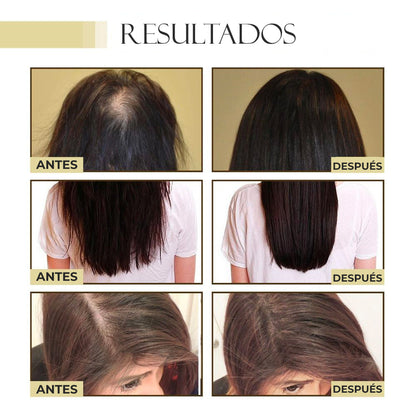 DivineDose™ - Aceite esencial fortalecedor de cabello