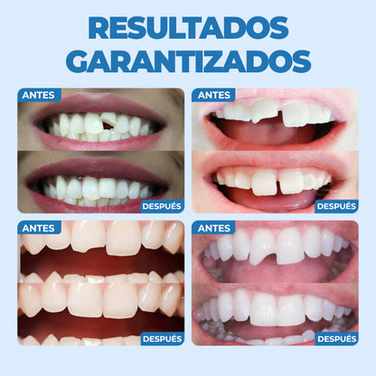 SmileSaver™ - Kit de dientes postizos