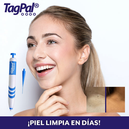 TagPal® – Kit de eliminación de skin tags indoloro y efectivo